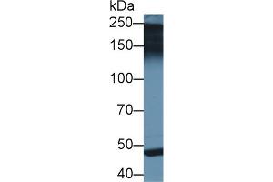 Western blot analysis of Rat Placenta lysate, using Human PAPPA2 Antibody (2 µg/ml) and HRP-conjugated Goat Anti-Rabbit antibody ( (PAPPA2 抗体  (AA 888-1093))