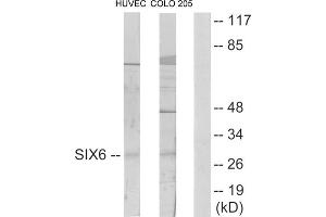Western blot analysis of extracts from HUVEC cells and COLO205 cells, using SIX6 antibody. (SIX Homeobox 6 抗体  (Internal Region))