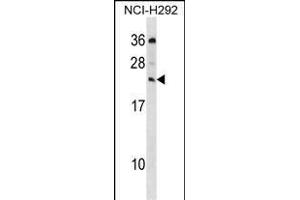 MED19 Antibody (C-term) (ABIN1536757 and ABIN2850102) western blot analysis in NCI- cell line lysates (35 μg/lane). (MED19 抗体  (C-Term))