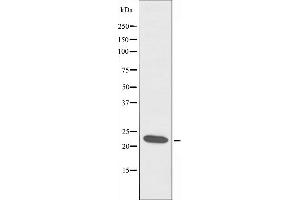 Western blot analysis of extracts from RAW264. (CIDEB 抗体  (Internal Region))