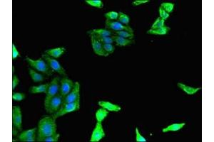 Immunofluorescent analysis of HepG2 cells using ABIN7160298 at dilution of 1:100 and Alexa Fluor 488-congugated AffiniPure Goat Anti-Rabbit IgG(H+L) (MADCAM1 抗体  (AA 19-317))