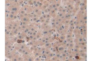 Used in DAB staining on fromalin fixed paraffin- embedded liver tissue (beta Defensin 1 抗体  (AA 22-69))