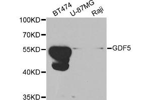 Western blot analysis of extracts of various cell lines, using GDF5 antibody. (GDF5 抗体)