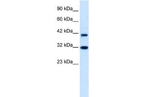 WB Suggested Anti-DPF1 Antibody Titration:  0. (DPF1 抗体  (Middle Region))