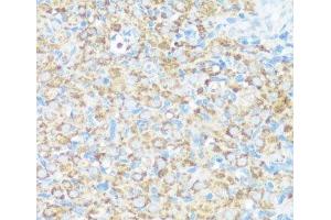 Immunohistochemistry of paraffin-embedded Rat ovary using NMT1 Polyclonal Antibody at dilution of 1:100 (40x lens). (NMT1 抗体)