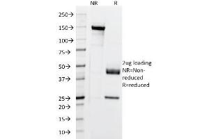 SDS-PAGE Analysis Purified Cytokeratin, 5/6/18 Mouse Monoclonal Antibody (SPM267). (Keratin 5,6,18 抗体)