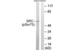 Western blot analysis of extracts from COLO205 cells treated with EGF 200ng/ml 30', using Src (Phospho-Ser75) Antibody. (Src 抗体  (pSer75))