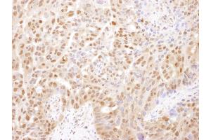 Immunohistochemistry (IHC) image for anti-Proteasome Subunit alpha 2 (PSMA2) (AA 184-234) antibody (ABIN7454564)