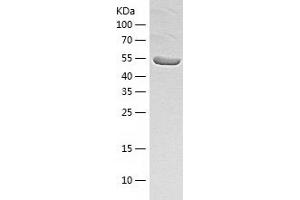 Western Blotting (WB) image for Aldehyde Dehydrogenase 2 Family (Mitochondrial) (ALDH2) (AA 18-517) protein (His tag) (ABIN7285009) (ALDH2 Protein (AA 18-517) (His tag))