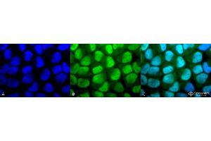 Immunocytochemistry/Immunofluorescence analysis using Rabbit Anti-Methylated Lysine Polyclonal Antibody . (Lysine (lys) (methylated) 抗体 (HRP))
