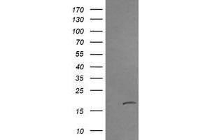 Image no. 2 for anti-Cancer/testis Antigen 1B (CTAG1B) antibody (ABIN1499893) (CTAG1B 抗体)
