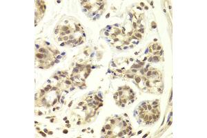 Immunohistochemistry of paraffin-embedded human breast using PRPF3 Antibody (ABIN5973192) at dilution of 1/100 (40x lens). (PRPF3 抗体)
