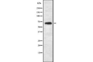 Western blot analysis of NBPF4 expression in 293T whole cell lysate ,The lane on the left is treated with the antigen-specific peptide. (NBPF4 抗体)