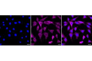 Immunocytochemical staining of C2C12 cells with Phospho-MEK1 (S298) antibody (ABIN7799462), 1:1,000). (Recombinant MEK1 抗体  (pSer298))