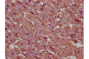 IHC image of ABIN7142862 diluted at 1:400 and staining in paraffin-embedded human heart tissue performed on a Leica BondTM system. (INPP5E 抗体  (AA 1-133))