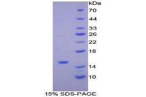 SDS-PAGE (SDS) image for Brain Natriuretic Peptide (BNP) (AA 77-121) protein (His tag,SUMO Tag) (ABIN1079003)
