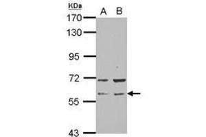 Image no. 2 for anti-RAP1, GTP-GDP Dissociation Stimulator 1 (RAP1GDS1) (N-Term) antibody (ABIN1494067) (RAP1GDS1 抗体  (N-Term))