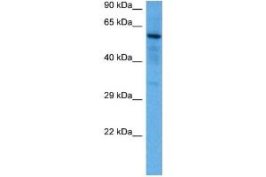 Host:  Mouse  Target Name:  SOX9  Sample Tissue:  Mouse Brain  Antibody Dilution:  1ug/ml (SOX9 抗体  (N-Term))