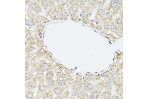 Immunohistochemistry of paraffin-embedded mouse liver using SAA3 antibody. (Serum Amyloid A3 Pseudogene (SAA3P) 抗体)