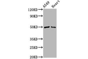 Western Blot Positive WB detected in: A549 whole cell lysate, Rat heart tissue All lanes: IRX6 antibody at 3. (IRX6 抗体  (AA 289-389))