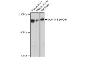 Western blot analysis of extracts of various cell lines, using Exportin 5 (XPO5) (XPO5) Rabbit mAb (ABIN1682763, ABIN3018126, ABIN3018127 and ABIN7101577) at 1:1000 dilution. (XPO5 抗体)