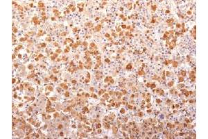 IHC testing of FFPE human pituitary gland with recombinant ACTH antibody (clone r57). (Recombinant ACTH 抗体  (AA 1-24))