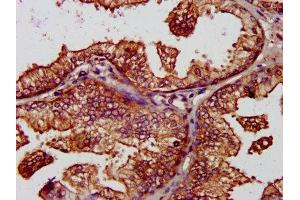 Immunohistochemistry (IHC) image for anti-B-Cell Receptor-Associated Protein 31 (BCAP31) (AA 2-243) antibody (ABIN7145178)