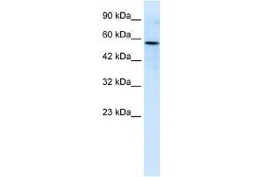 Human Jurkat; WB Suggested Anti-RIPX Antibody Titration: 0. (RUFY3 抗体  (C-Term))