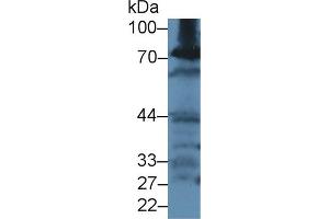 Western blot analysis of Rat Kidney lysate, using Rat GCLC Antibody (2 µg/ml) and HRP-conjugated Goat Anti-Rabbit antibody (