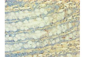 Immunohistochemistry of paraffin-embedded human colon tissue using ABIN7160897 at dilution of 1:50 (NDUFA3 抗体  (AA 2-84))