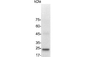 SDS-PAGE (SDS) image for Interleukin 6 (IL6) (Active) protein (His tag) (ABIN7884510)