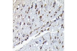 Immunohistochemistry of paraffin-embedded rat brain using TTC11/FIS1 antibody (ABIN7267209) at dilution of 1:100 (40x lens). (Fission 1 抗体)