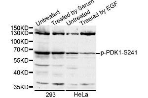 Western blot analysis of extracts of various cell lines, using Phospho-PDK1-S241 antibody. (PDPK1 抗体  (pSer241))