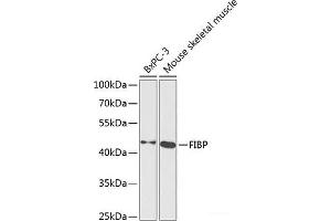 Western blot analysis of extracts of various cell lines using FIBP Polyclonal Antibody at dilution of 1:1000. (FIBP 抗体)