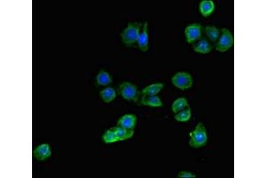 Immunofluorescent analysis of PC-3 cells using ABIN7143660 at dilution of 1:100 and Alexa Fluor 488-congugated AffiniPure Goat Anti-Rabbit IgG(H+L) (ALDH1A3 抗体  (AA 2-210))