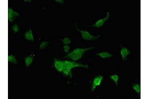 Immunofluorescence (IF) image for anti-Forkhead Box K1 (Foxk1) (AA 621-730) antibody (ABIN7153058)