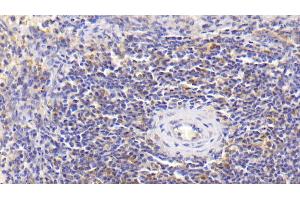Detection of IL18 in Human Spleen Tissue using Monoclonal Antibody to Interleukin 18 (IL18) (IL-18 抗体  (AA 94-193))