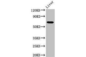 Western Blot Positive WB detected in: Mouse liver tissue All lanes: SENP2 antibody at 3. (SENP2 抗体  (AA 138-324))