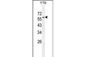 ZN Antibody (C-term) (ABIN654976 and ABIN2844616) western blot analysis in Y79 cell line lysates (35 μg/lane). (ZNF678 抗体  (C-Term))