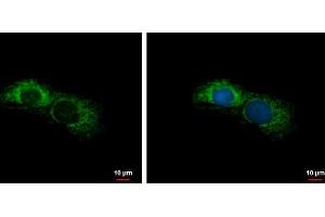 ICC/IF Image ALDH7A1 antibody detects ALDH7A1 protein at mitochondria by immunofluorescent analysis. (ALDH7A1 抗体)