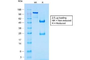 SDS-PAGE Analysis of Purified Chromogranin A Rabbit Recombinant Monoclonal Antib (CHGA/1731R). (Recombinant Chromogranin A 抗体)