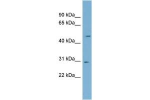 Western Blotting (WB) image for anti-NADH Dehydrogenase (Ubiquinone) Fe-S Protein 3, 30kDa (NADH-Coenzyme Q Reductase) (NDUFS3) (Middle Region) antibody (ABIN2786779)