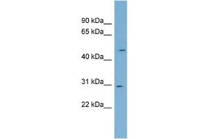 WB Suggested Anti-NDUFS3 Antibody Titration: 0.