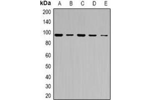 Western blot analysis of ABCF1 expression in HeLa (A), COLO205 (B), HCT116 (C), mouse testis (D), rat testis (E) whole cell lysates.