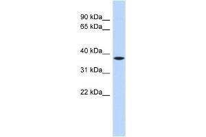 C22ORF30 antibody used at 1 ug/ml to detect target protein. (C22ORF30 抗体  (Middle Region))