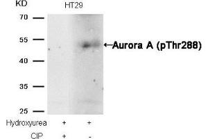 Western blot analysis of extracts from HT29 cells, treated with Hydroxyurea or calf intestinal phosphatase (CIP), using Aurora A (phospho-Thr288) Antibody.