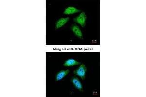 ICC/IF Image Immunofluorescence analysis of paraformaldehyde-fixed HeLa, using CtBP1, antibody at 1:200 dilution. (CTBP1 抗体  (Center))