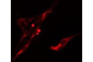 ABIN6275614 staining  LOVO cells by IF/ICC. (UBASH3A 抗体  (Internal Region))
