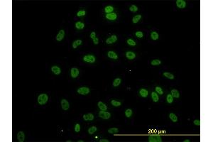 Immunofluorescence of monoclonal antibody to SURB7 on HeLa cell. (MED21 抗体  (AA 1-144))