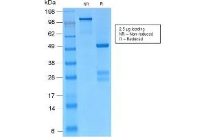 SDS-PAGE Analysis Purified Catenin, gamma Rabbit Monoclonal Antibody (CTNG/2155R). (Recombinant JUP 抗体)